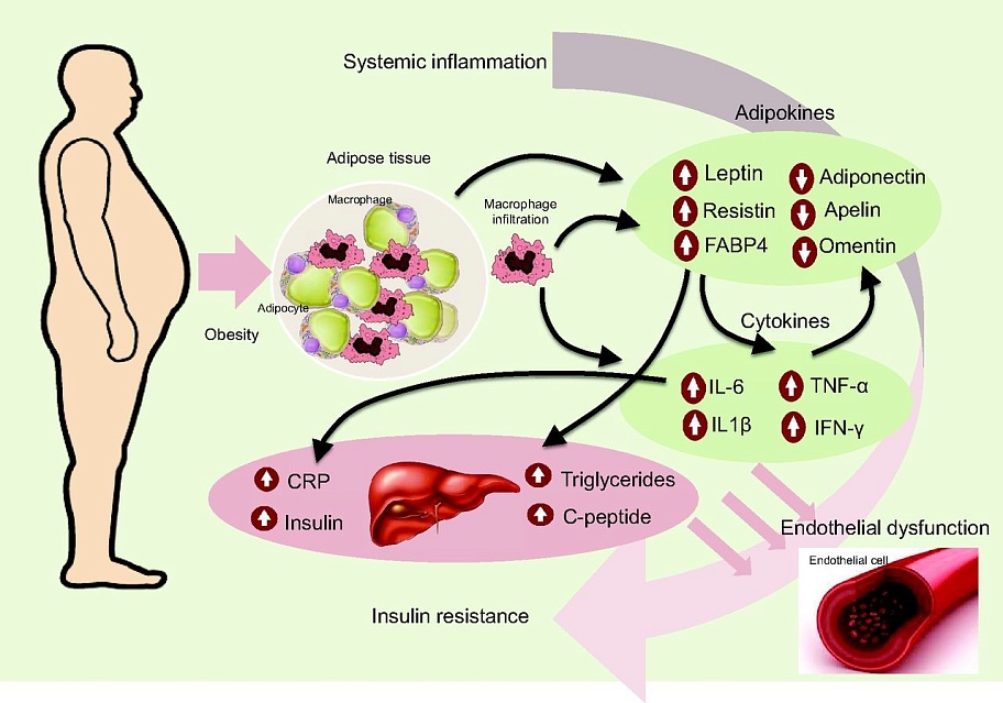 Воспаление: считать следствием или причиной ожирения?